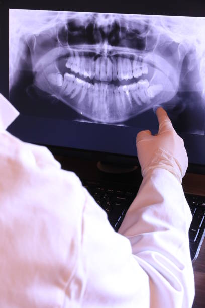 Best Emergency Denture Repair in Washburn, WI